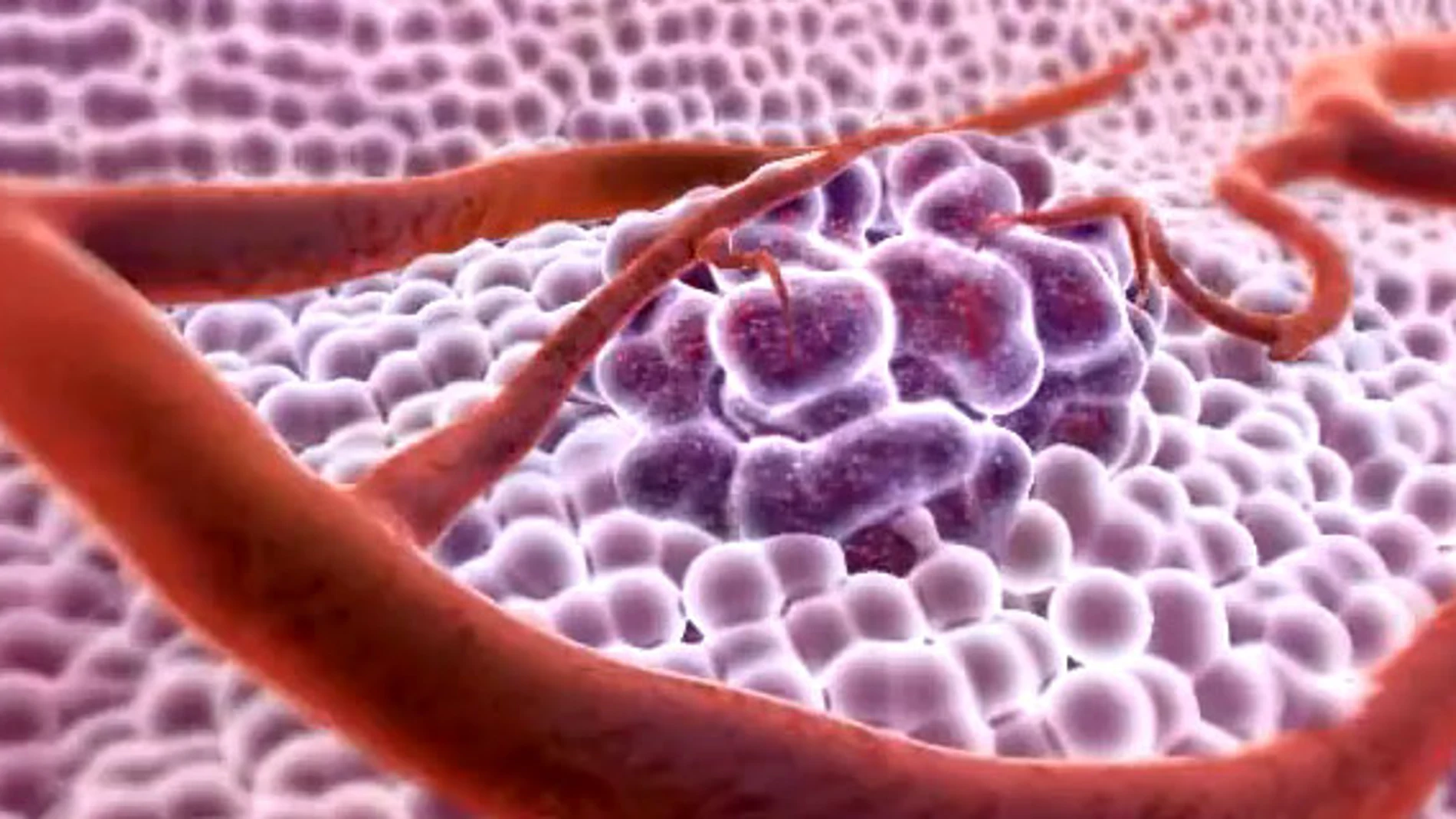 Tecnología 3D contra el cáncer