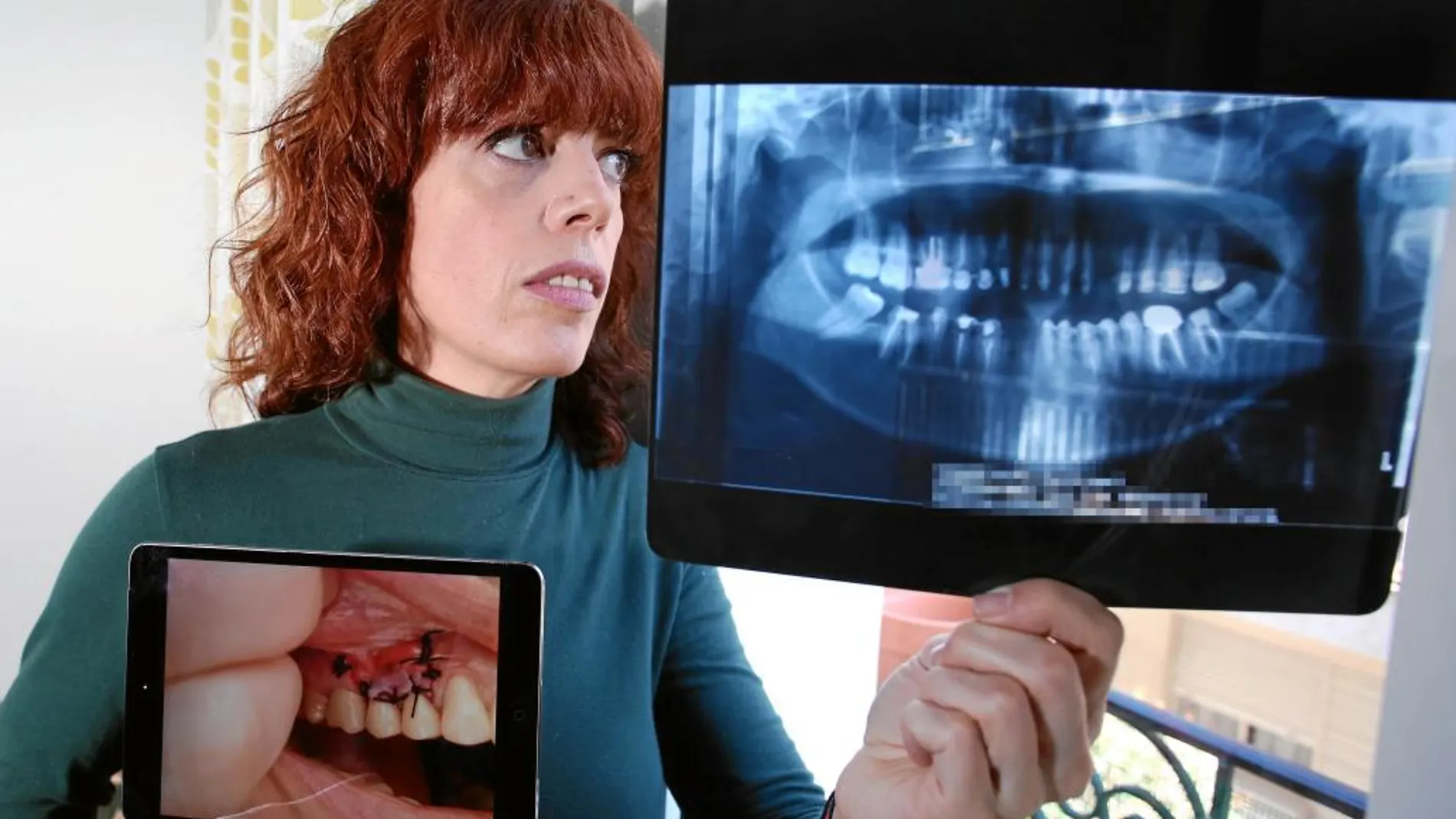 María José muestra una radiografía y la imagen de una de sus encías. Ha pasado hasta cuatro veces por quirófano. Debe usar un aparato y sufrirá las secuelas de por vida