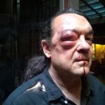 Brutal agresión a un miembro de Podemos en Castilla-La Mancha