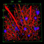 Representación tridimensional de los astrocitos, las placas y los vasos sanguíneos