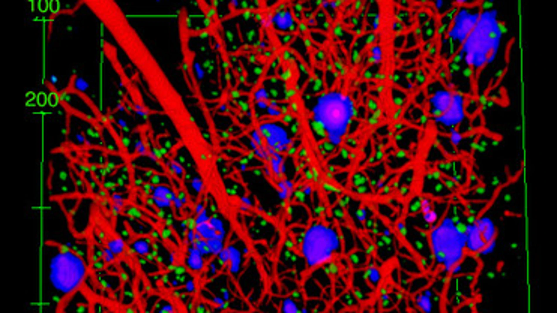 Representación tridimensional de los astrocitos, las placas y los vasos sanguíneos