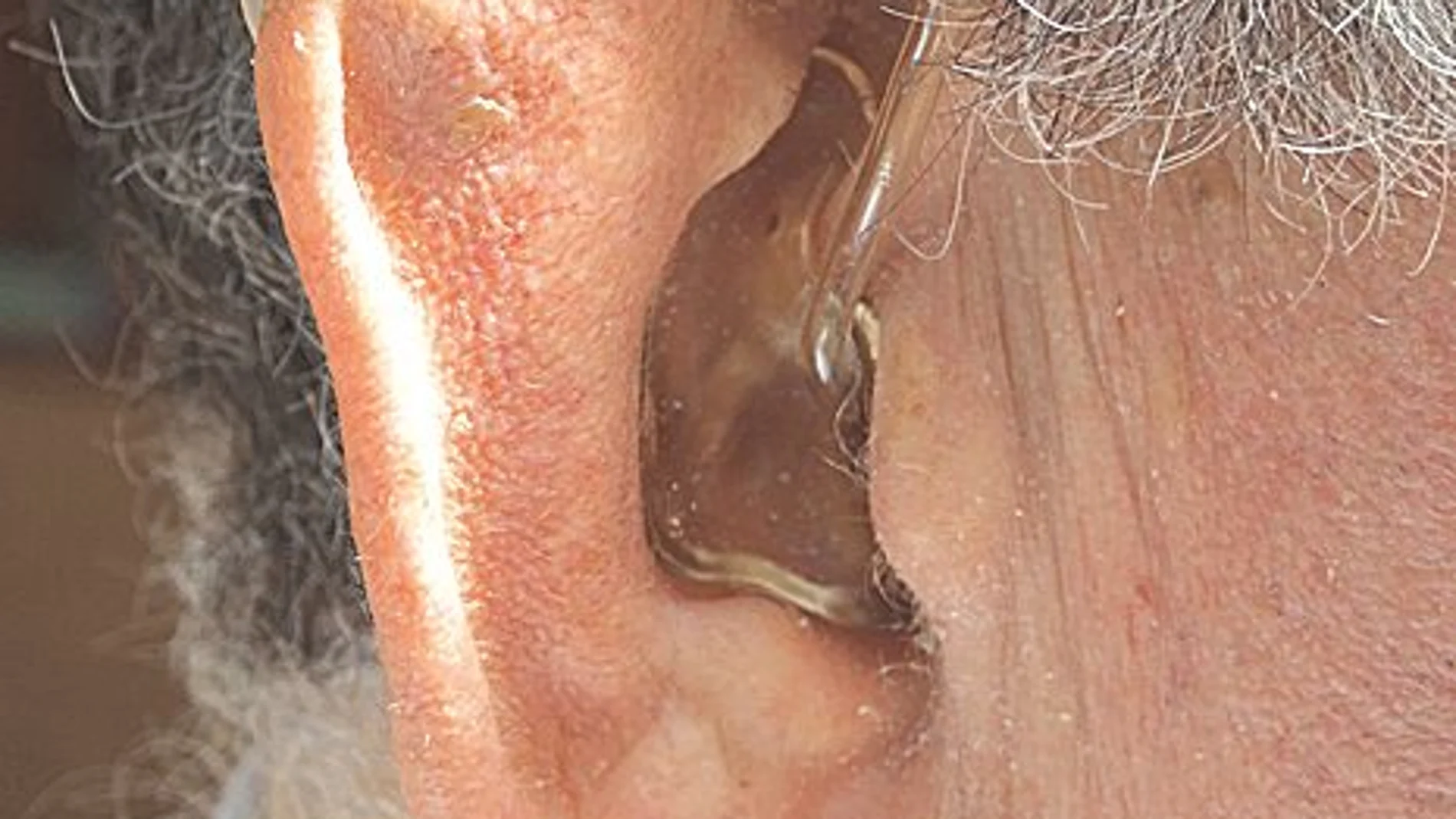 Los investigadores han concluido que la pérdida auditiva se asocia con un aumento del 87% en el riesgo de fragilidad
