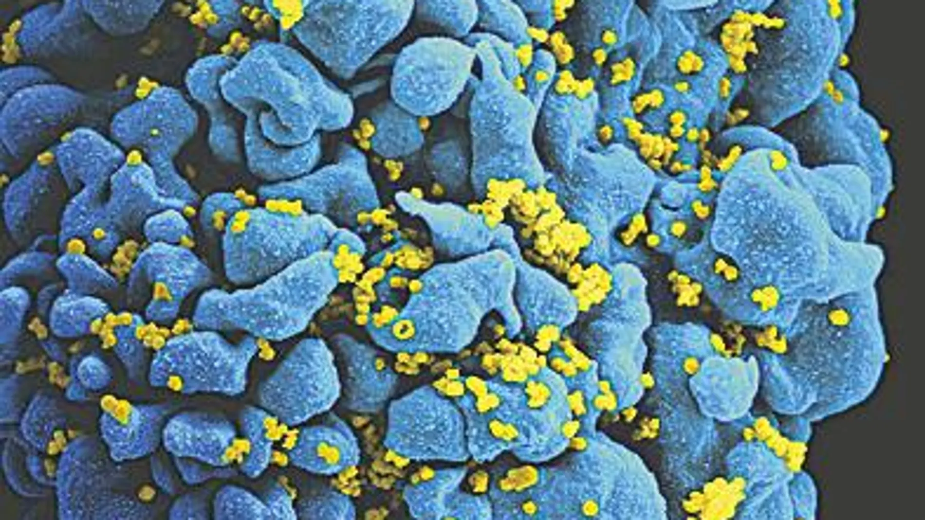 Un célula T infectada con VIH