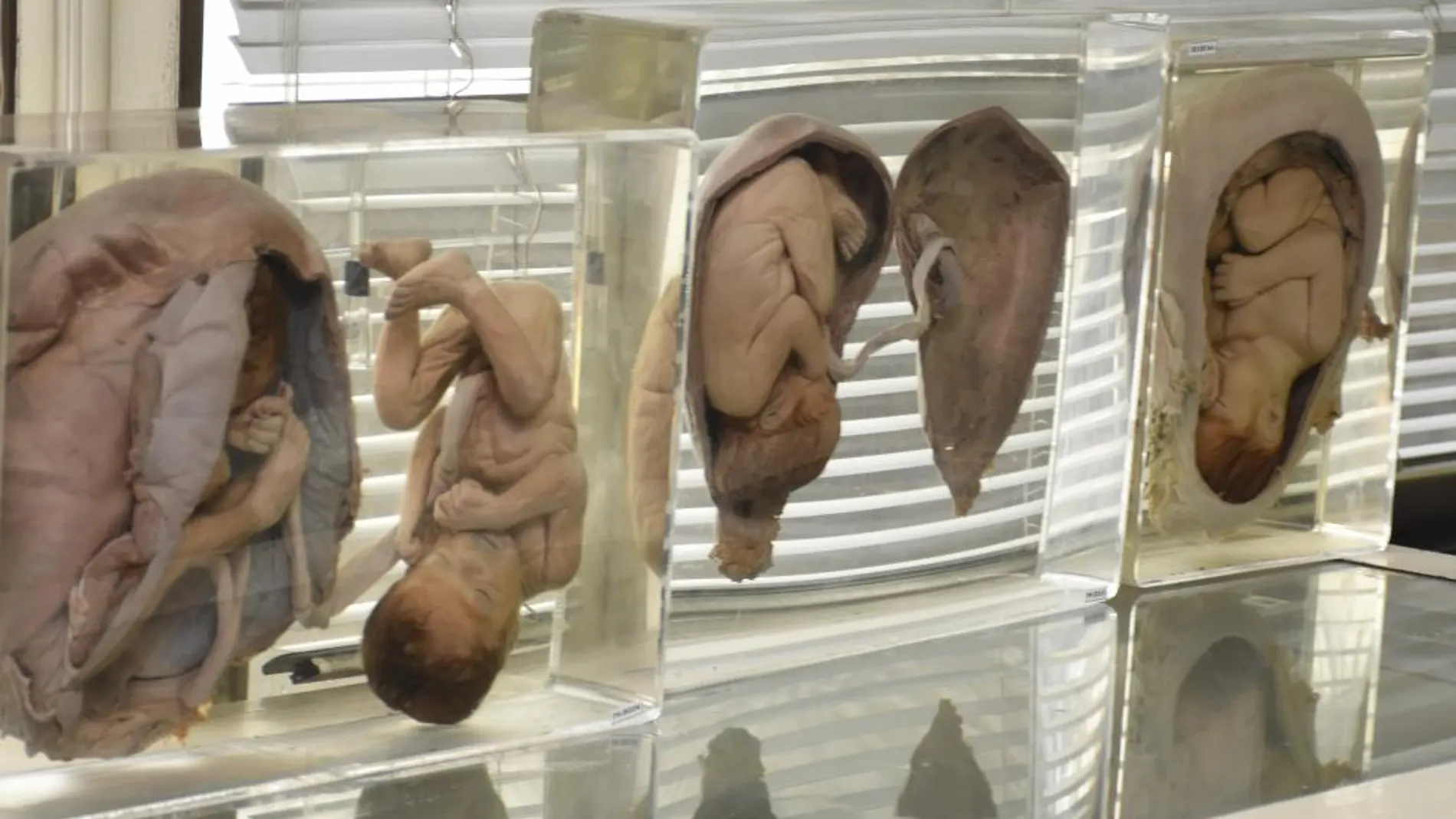 Fotografía facilitada por el Departamento forense del complejo hospitalario de Sijirat de varios fetos exhibidos en el museo forense del Hospital.