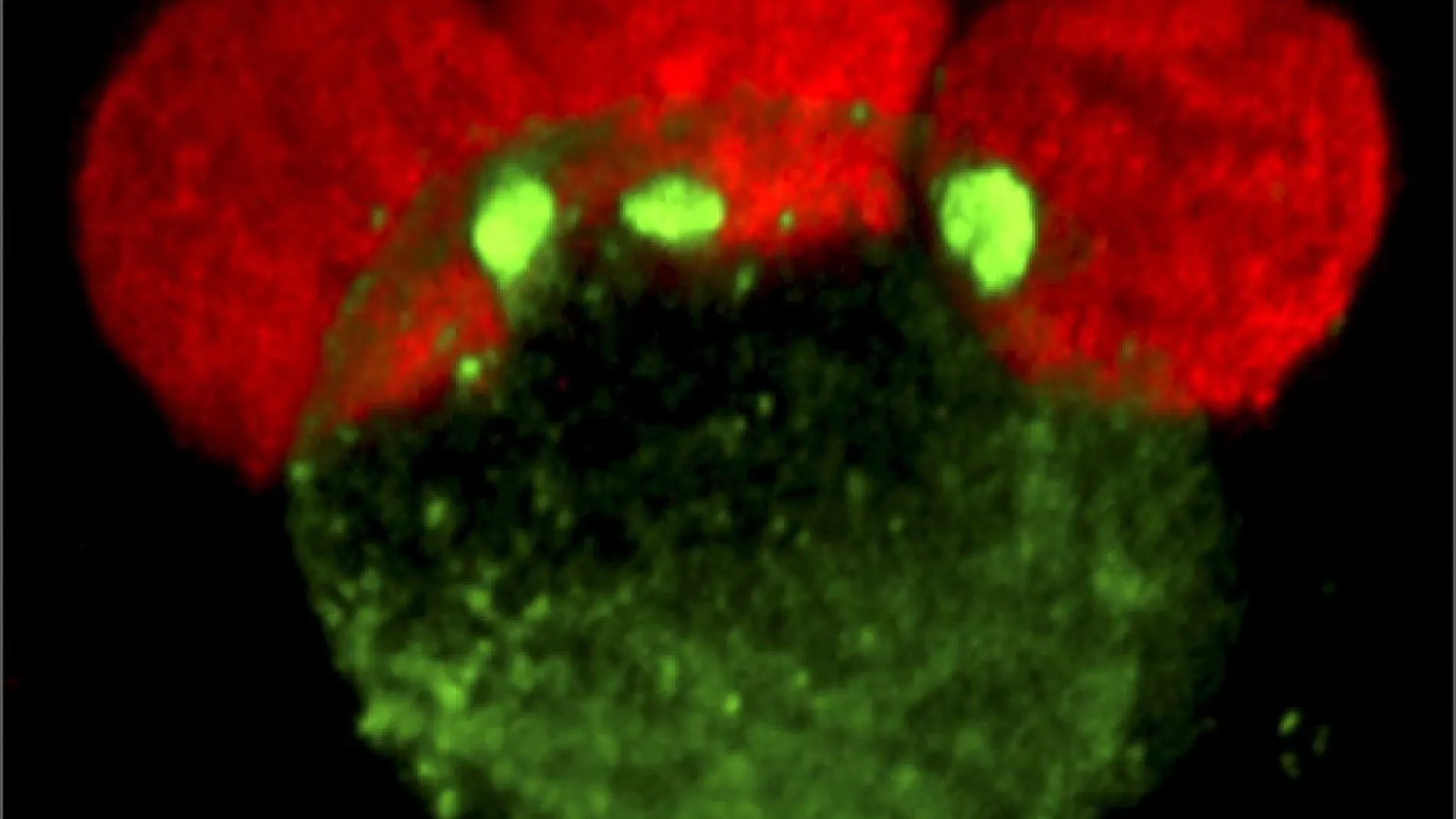 Célula infectada por el virus del sida, en una imagen de archivo