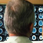 Un investigador analiza radiografías de cerebros con Alzheimer