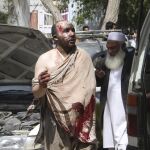 Un afgano, herido tras el accidente de tráfico se dirige al hospital en Ghazni