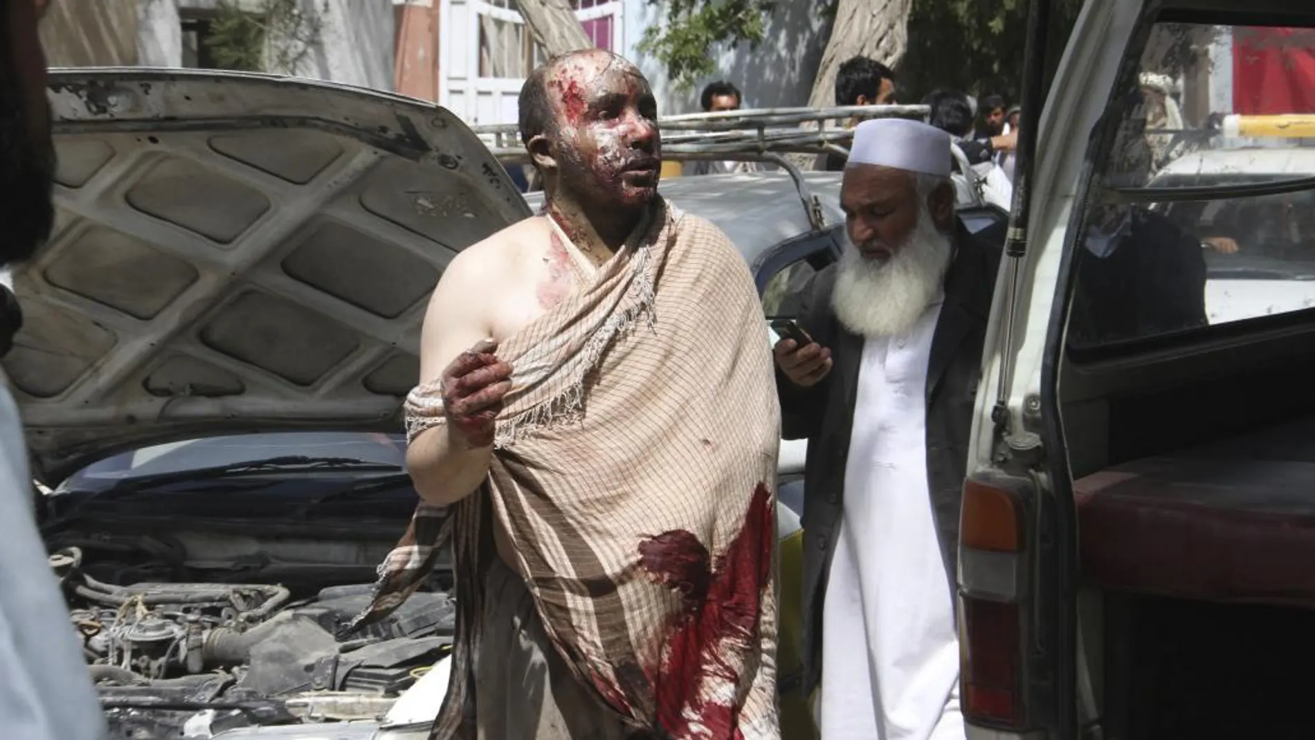 Un afgano, herido tras el accidente de tráfico se dirige al hospital en Ghazni
