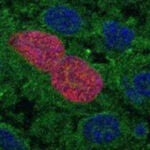 Imagen representativa de la proliferación inducida por la presencia de AID en células epiteliales de páncreas