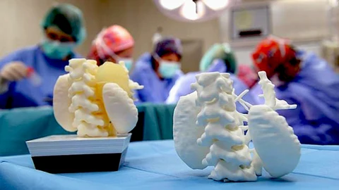 Avanza la impresión 3D para generar órganos humanos