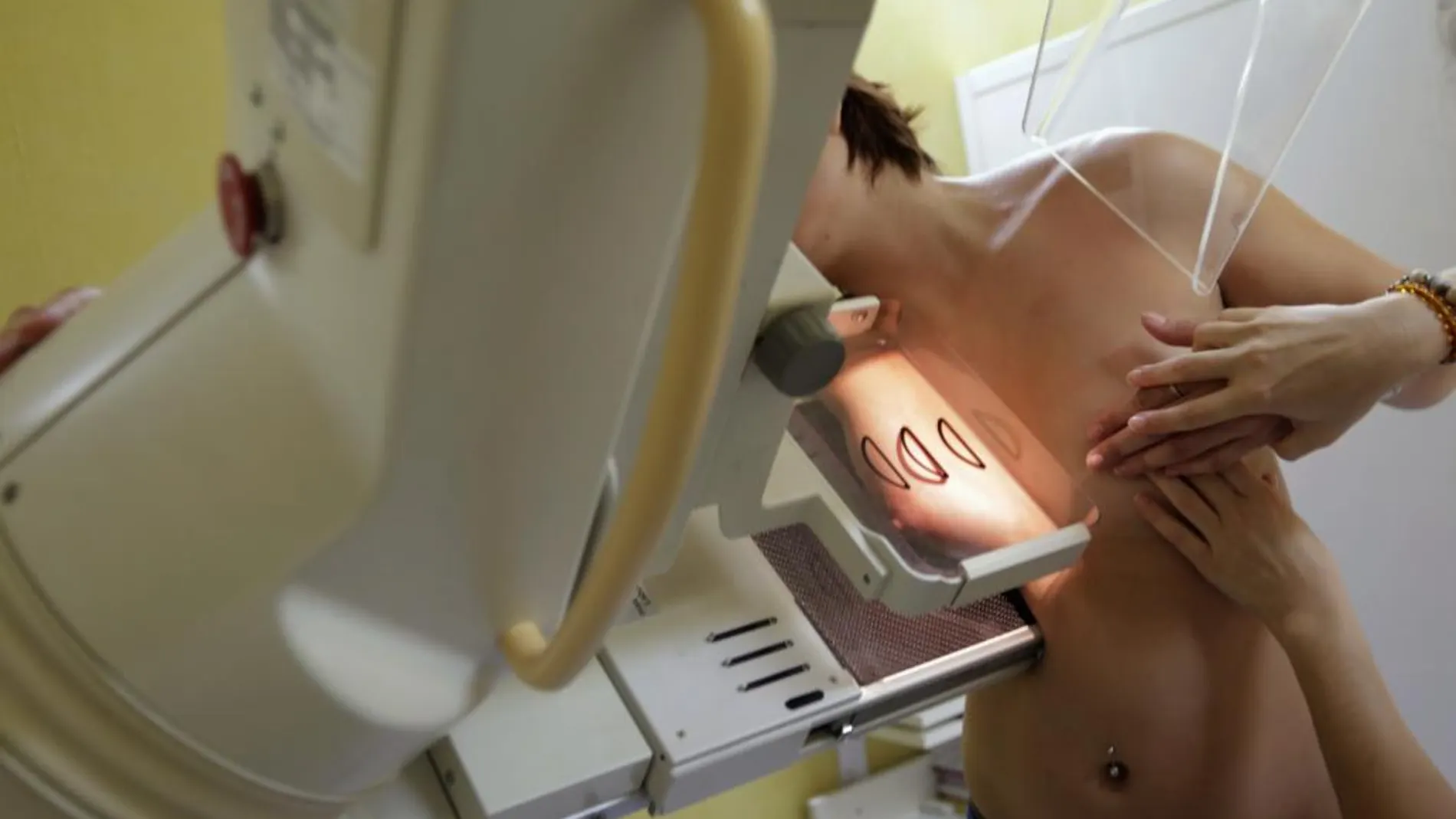 Una mujer se somete a una mamografía para prevenir el cáncer de mama