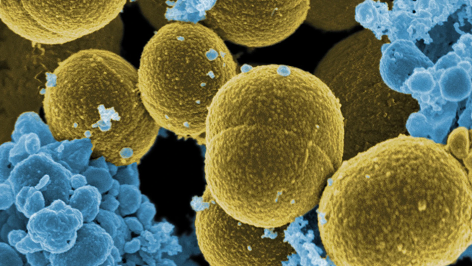 Bacteria del Staphylococcus aurea