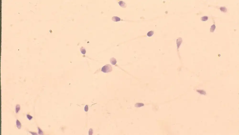 Espermatozoides a la vista de microscopio