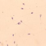 Espermatozoides vistos en un microscopio
