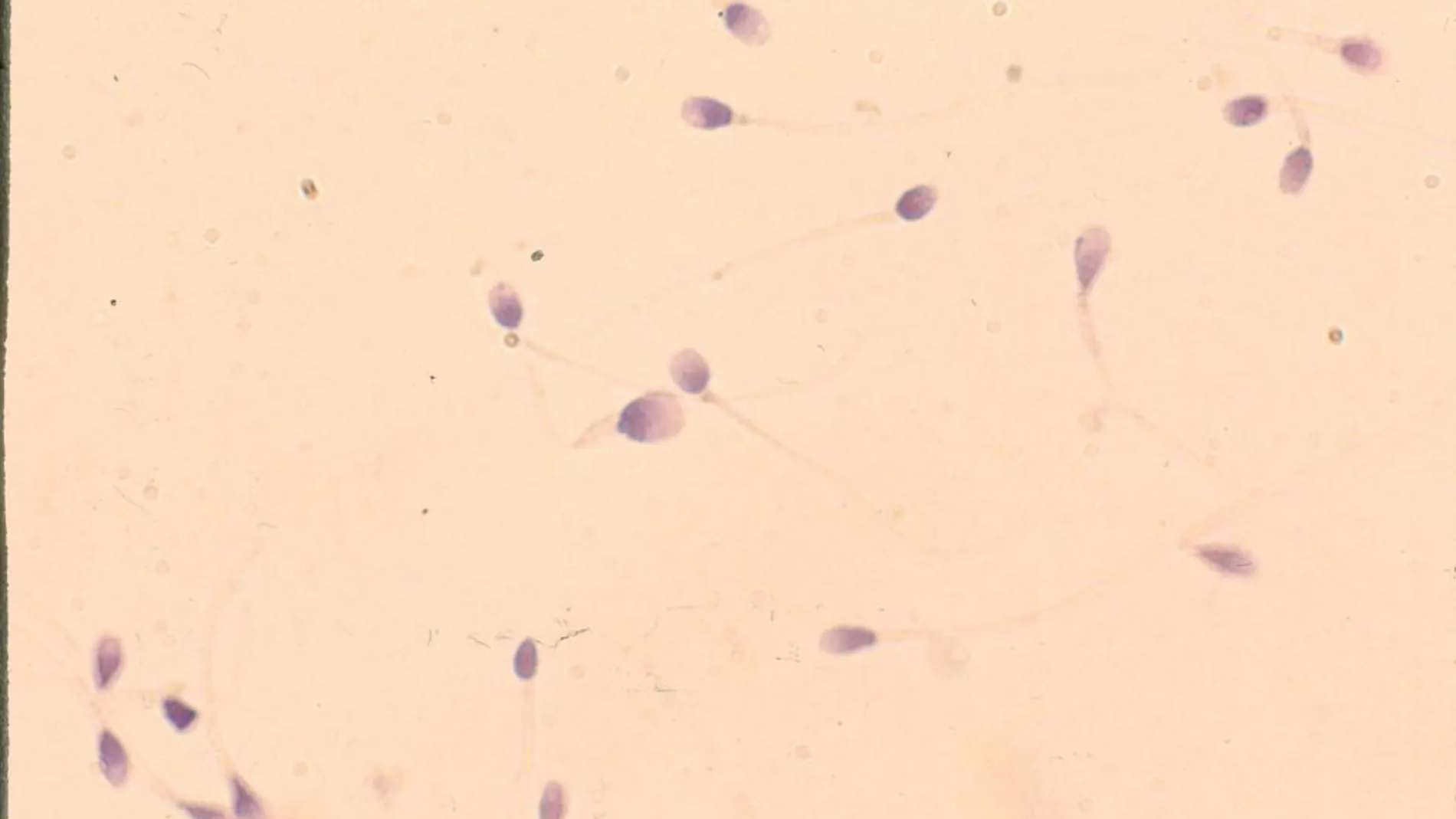 Espermatozoides vistos en un microscopio