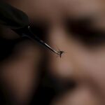 Sanidad confirma un segundo caso de malformación cerebral en un feto por zika