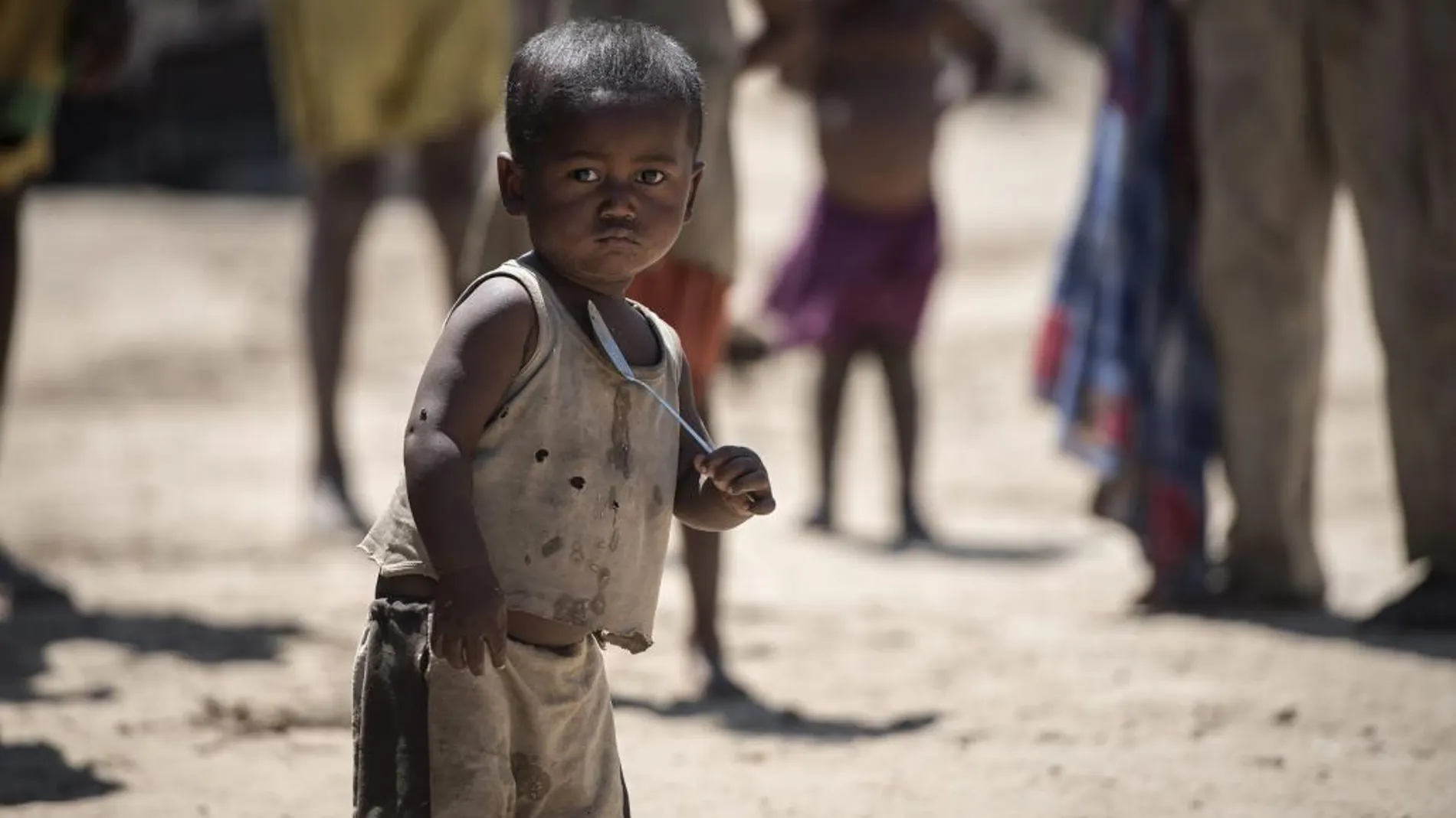 Un niño, que sufre de desnutrición, sostiene una cuchara en la ciudad de Amboasary, Madagascar