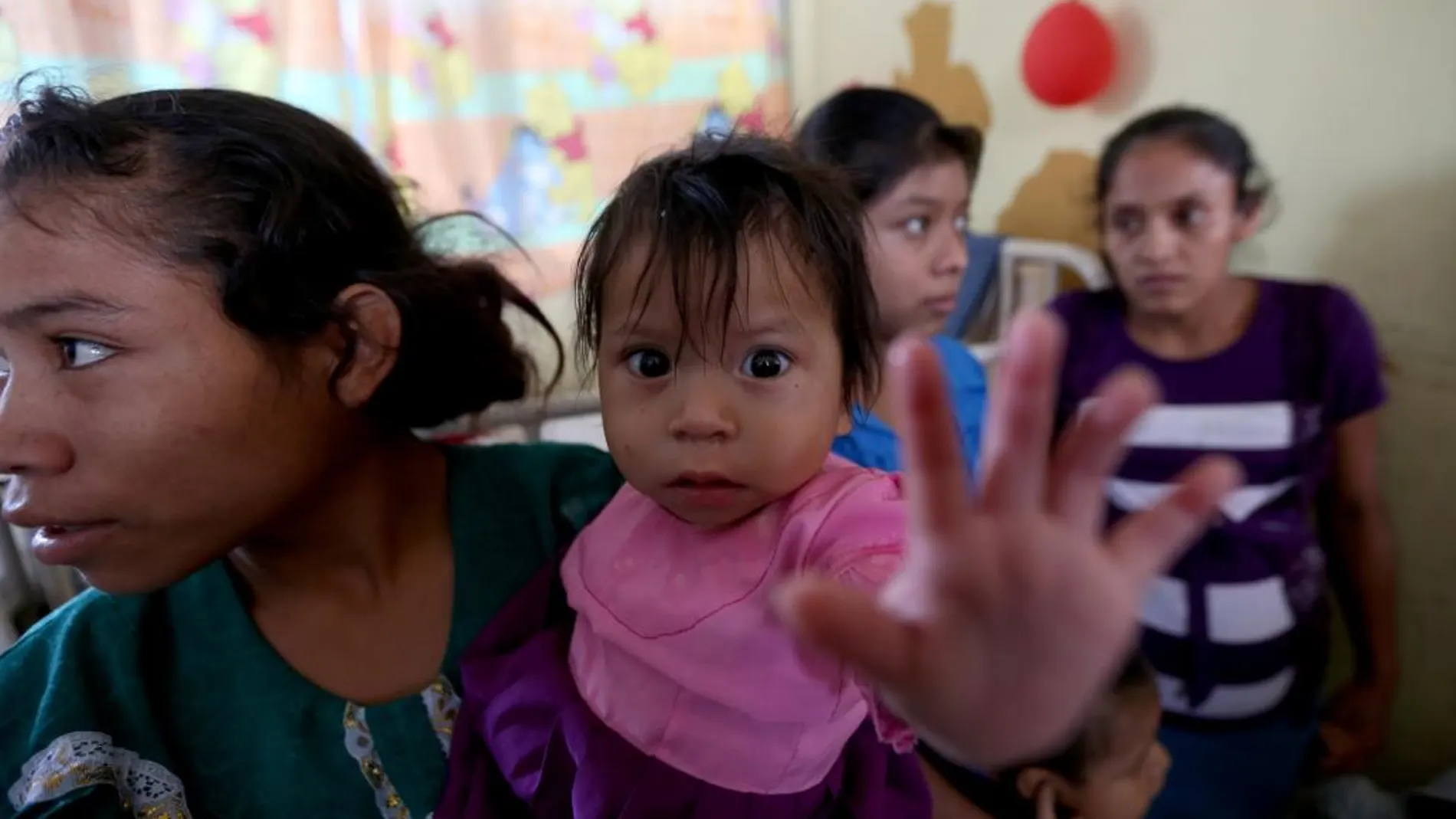 La pequeña Yesenia en el centro de atención nutricional en el municipio de Jocotán, Chiquimula