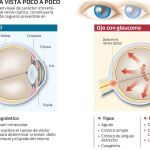 La mitad de las personas con glaucoma no lo sabe