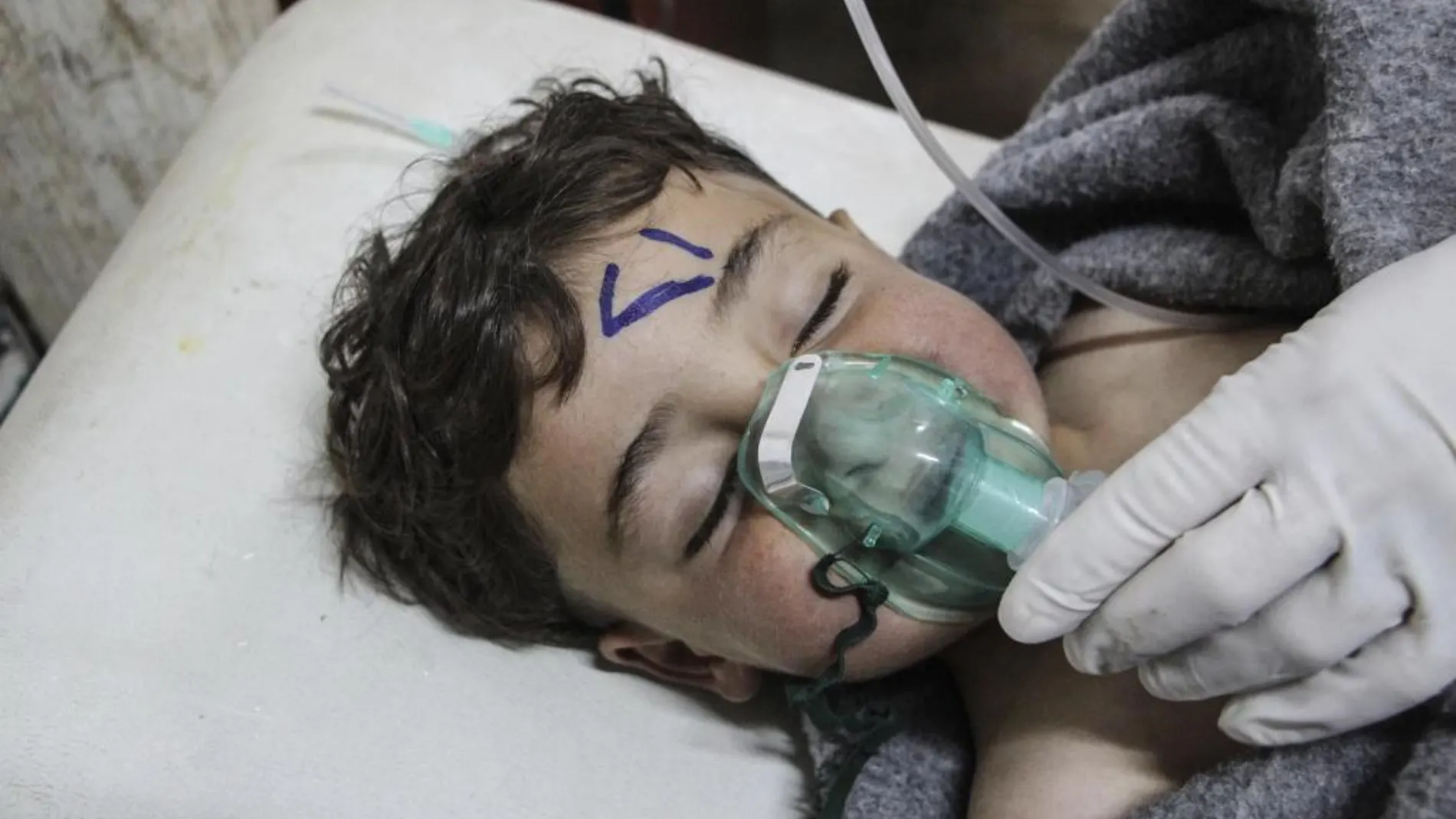 Un niño recibe tratamiento médico tras el ataque químico contra la localidad de Jan Shijún