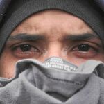 Un opositor, ayer, con los ojos afectados por los gases lacrimógenos durante una manifestación