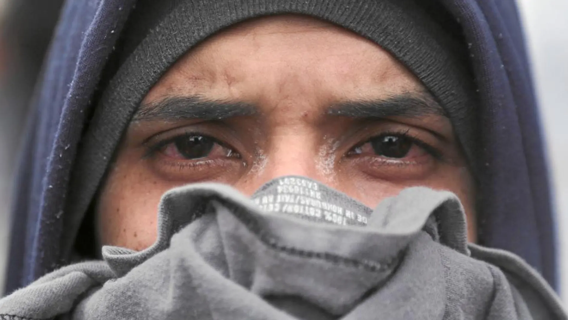 Un opositor, ayer, con los ojos afectados por los gases lacrimógenos durante una manifestación