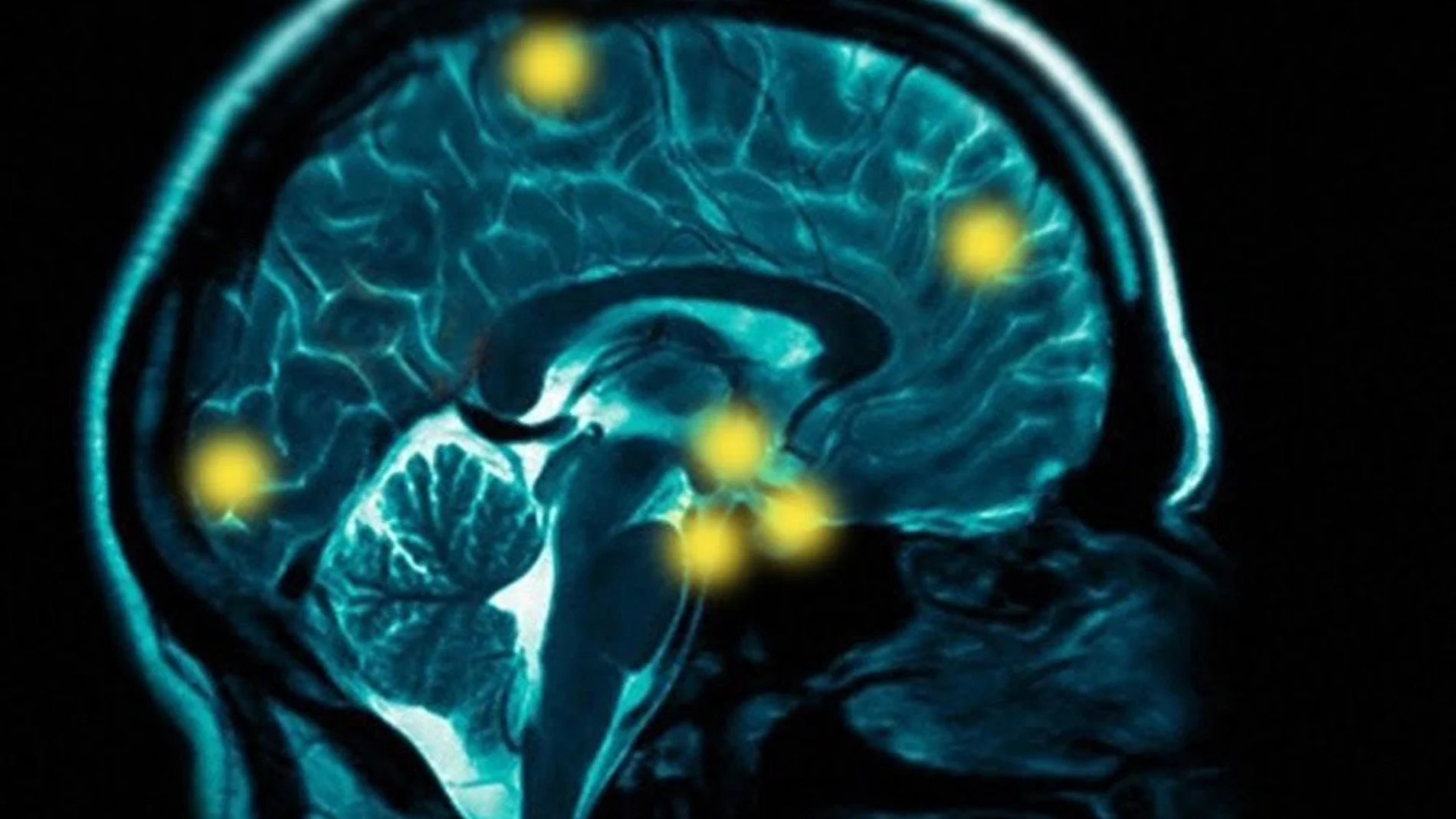 Un escáner del cerebro, en una imagen de archivo