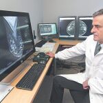 Un mamógrafo que permite detectar un 40% más de tumores