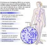 Un 60% de pacientes con linfoma logra superar la enfermedad