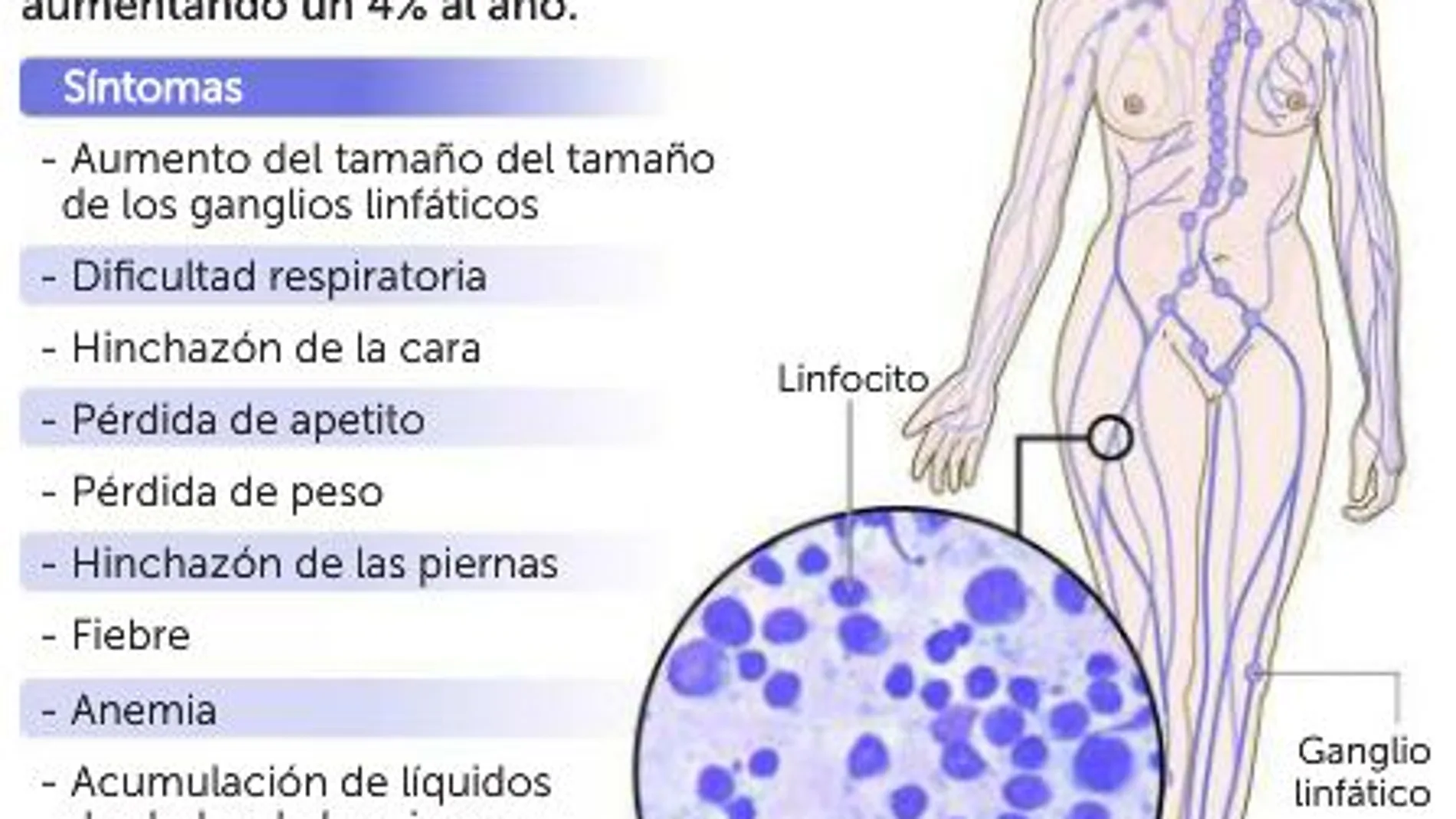 Un 60% de pacientes con linfoma logra superar la enfermedad