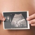 Respaldo al doble control médico de la ley del aborto