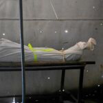 Un cuerpo yace sobre una mesa de una morgue improvisada y atacada en Duma (Siria)