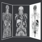 La primera resonancia magnética adaptable a todo tipo de cuerpo