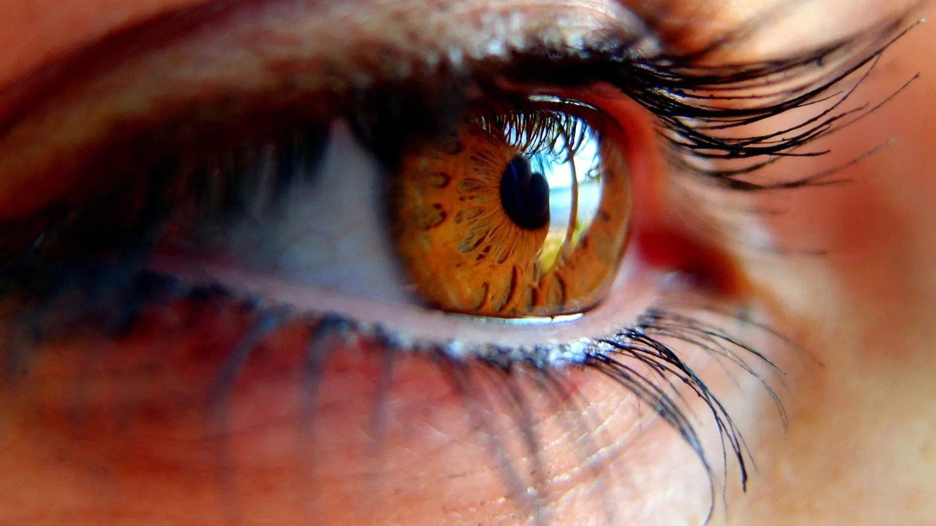 Los pacientes con diabetes que van al oftalmólogo presentan ya algún grado de pérdida de visión