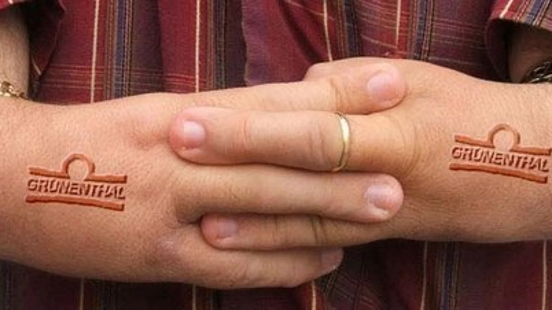 Imagen de un afectado con el logo de la compañía alemana pintado en ambas manos