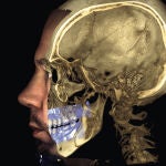 10 ventajas de la tecnología 3D para el diagnóstico y tratamiento de las deformidades dentofaciales