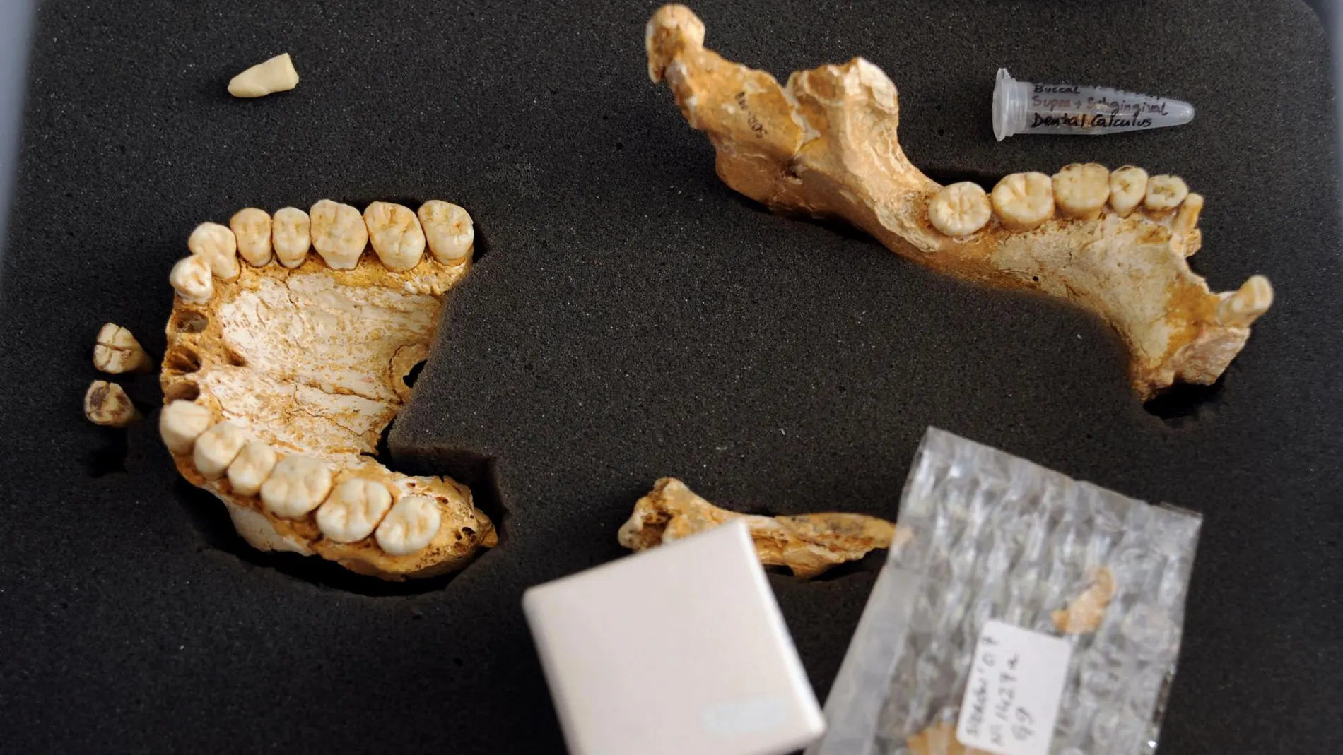 Restos dentales de antepasados, en una de las múltiples investigaciones realizadas sobre nuestros antepasados / Efe