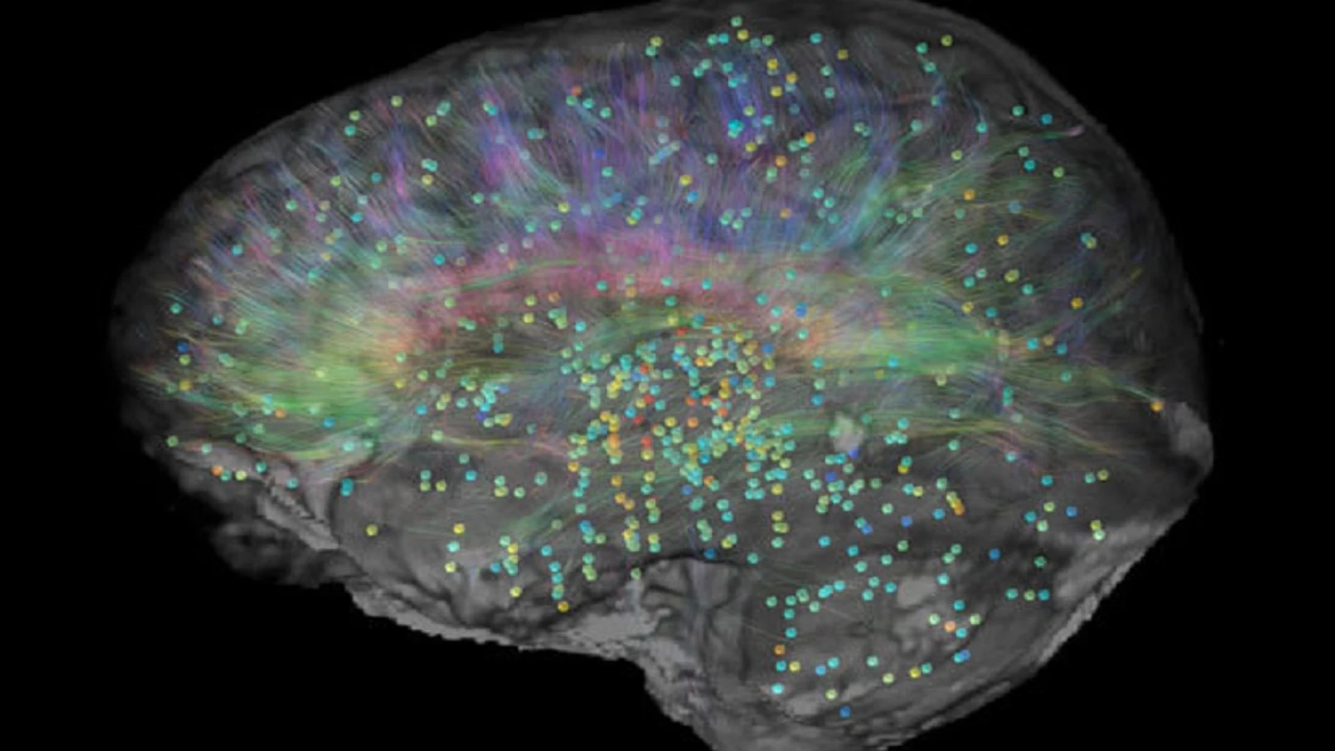 Atlas del cerebro