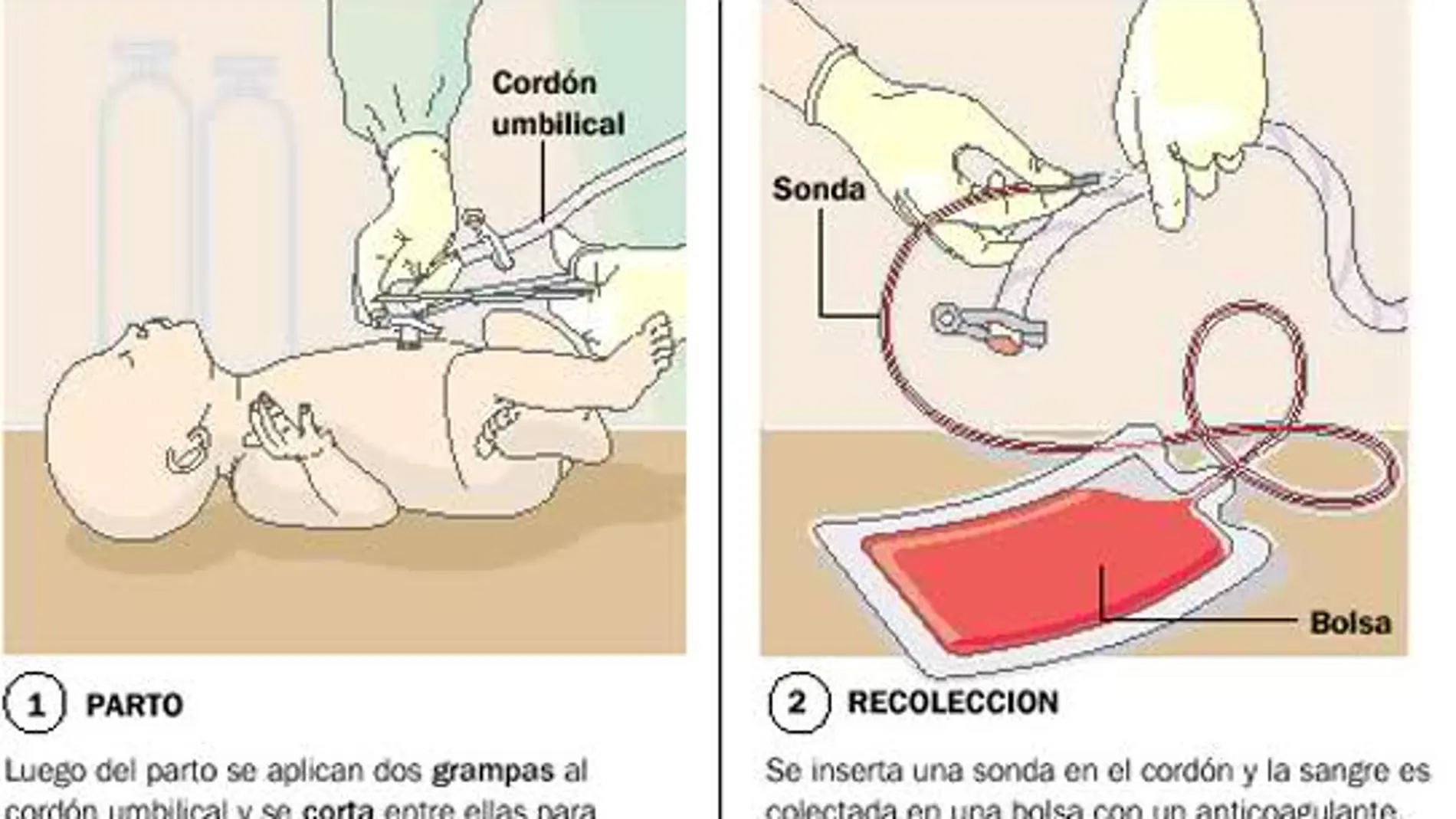 El almacenamiento de células madre extraídas del cordón umbilical: nociones básicas.