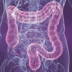 Las enfermedades inflamatorias intestinales aumentan en España