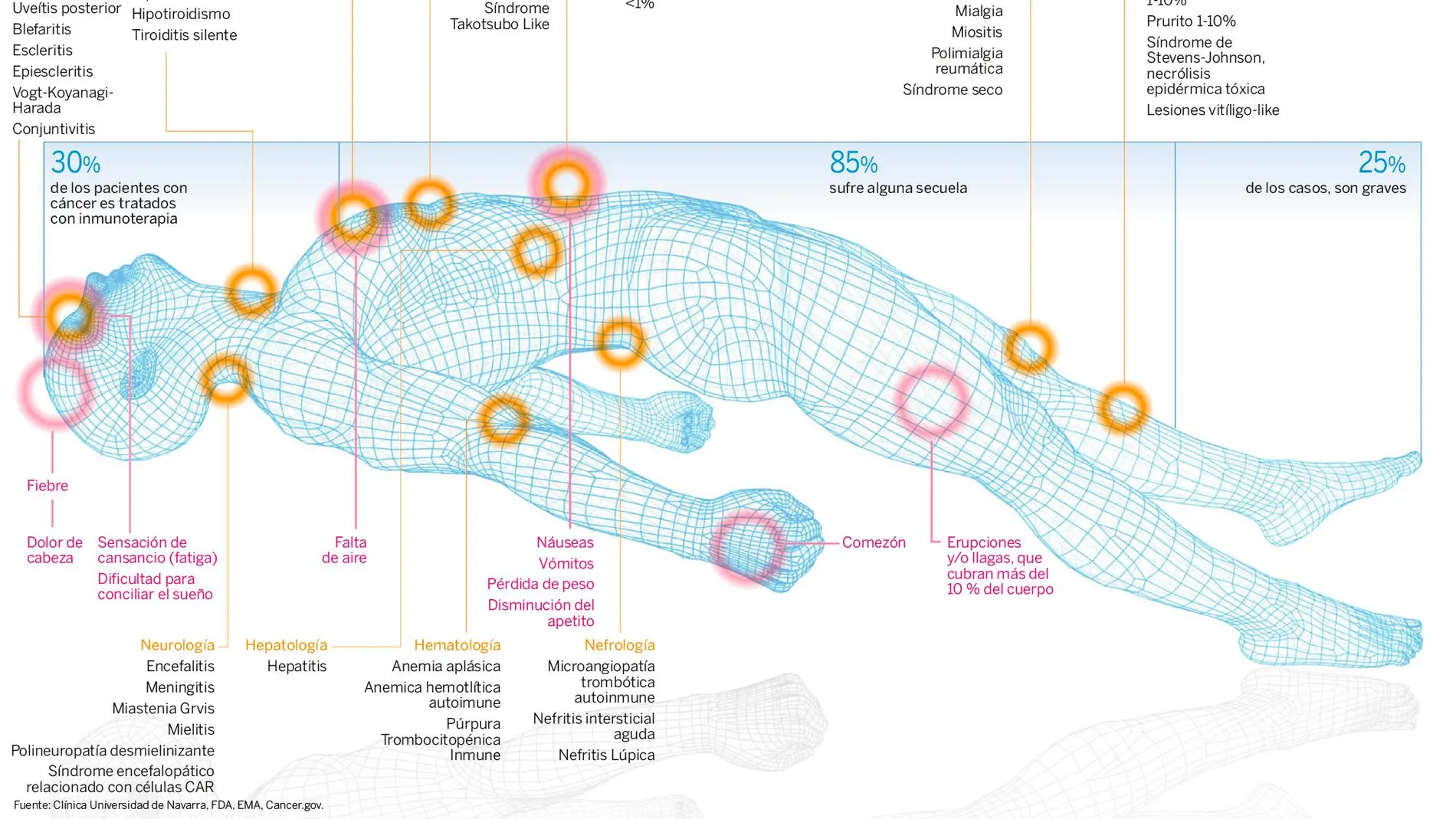 Inmunoterapia: un 80% de los pacientes sufre las secuelas de la terapia «estrella» contra el cáncer