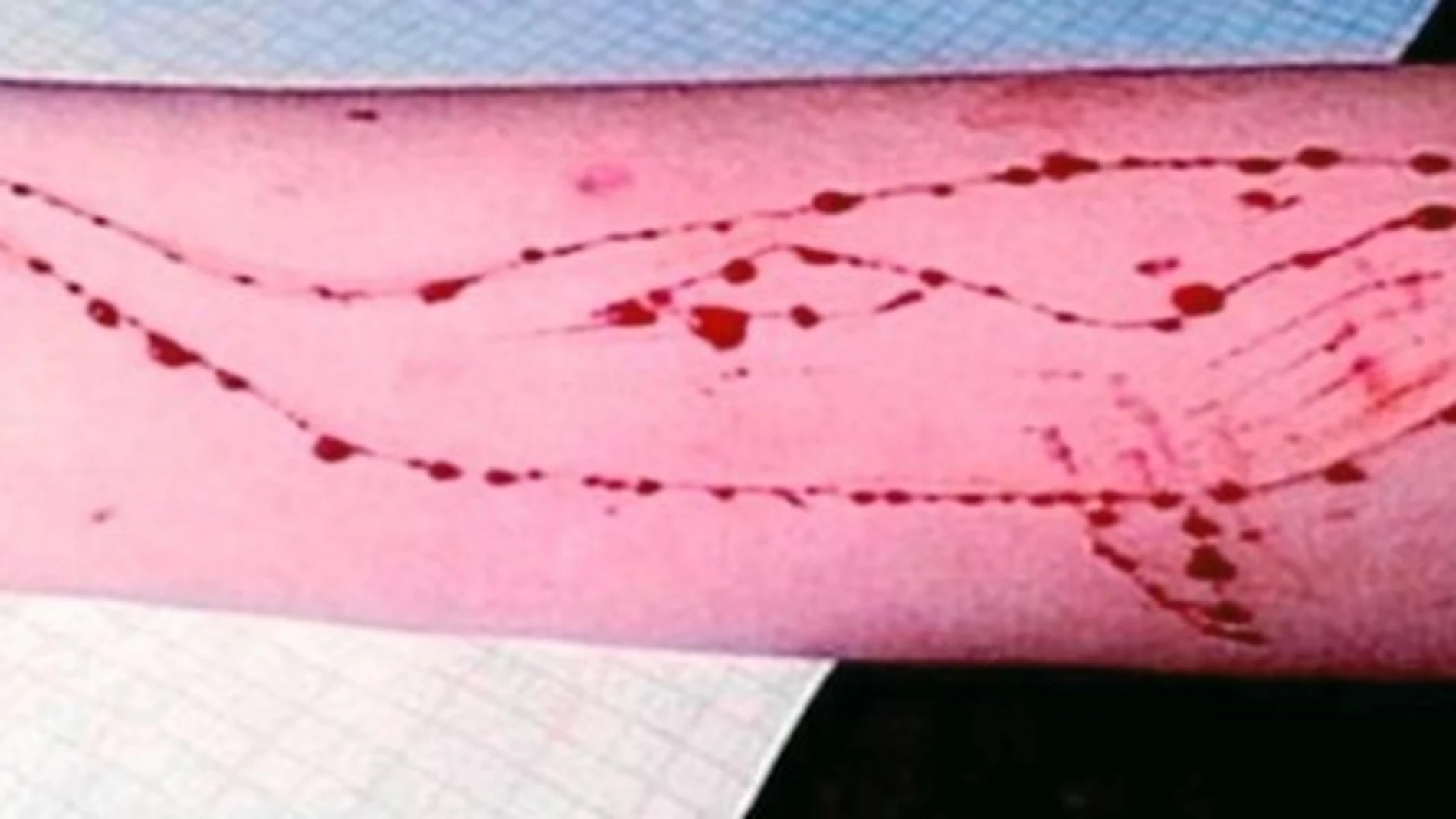 Imagen del brazo de un joven con cortes en forma de ballena azul