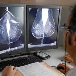 Estudio una mamografía digital, en el servicio de mamografías del Hospital Río Hortega de Valladolid.