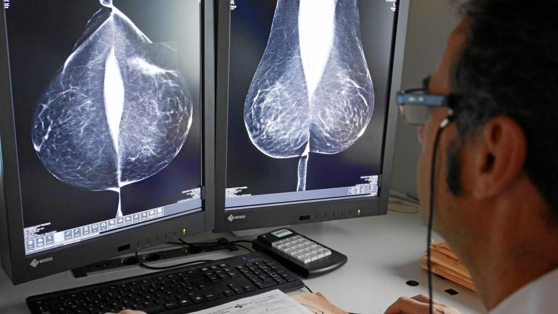 Estudio una mamografía digital, en el servicio de mamografías del Hospital Río Hortega de Valladolid.