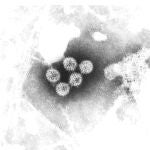 El rotavirus humano, visto al microscopio