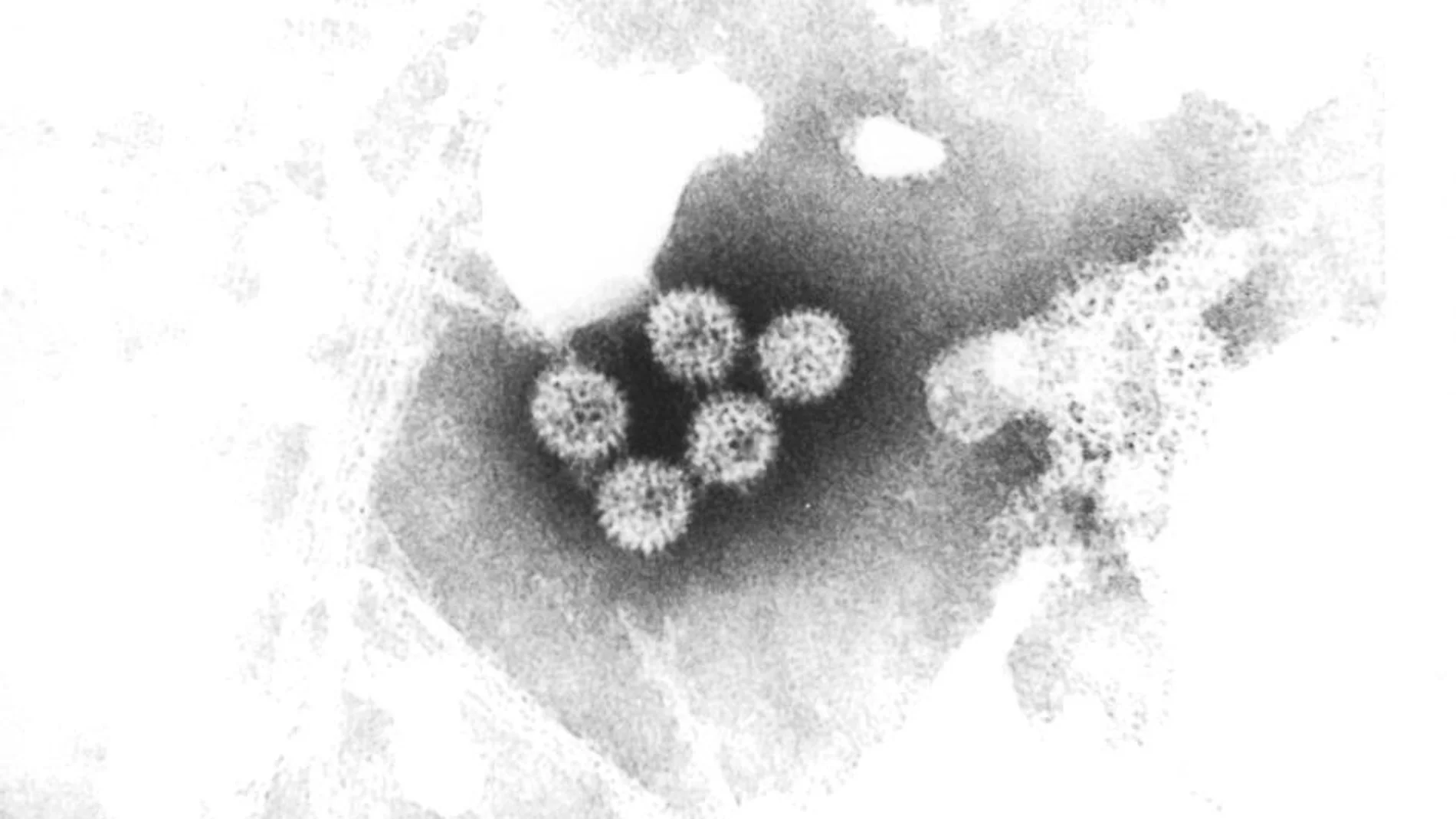 El rotavirus humano, visto al microscopio