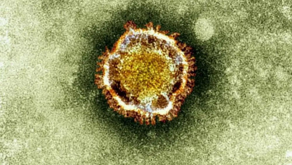 Imagen del coronavirus en un microscopio electrónico