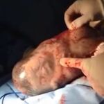 El médico señala al bebé para indicar que está bostezando