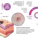 La huellas del carcinoma basocelular