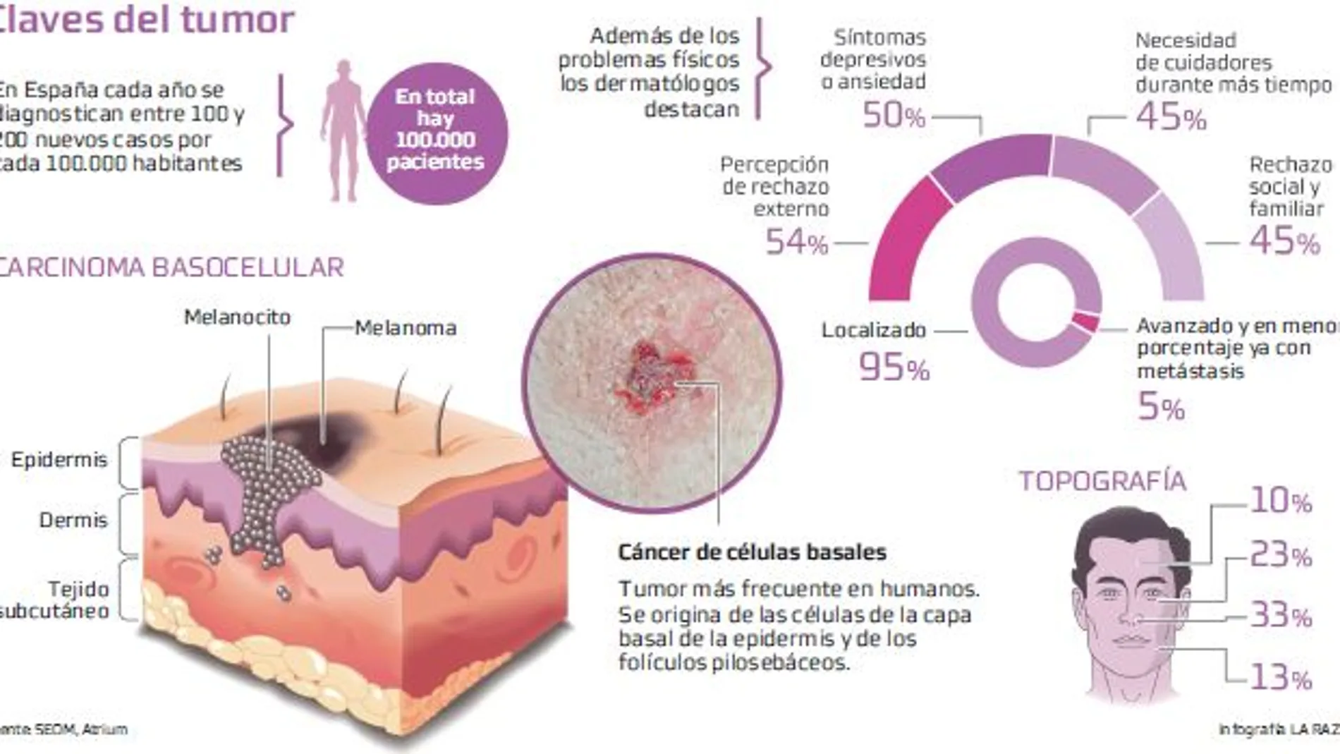 La huellas del carcinoma basocelular